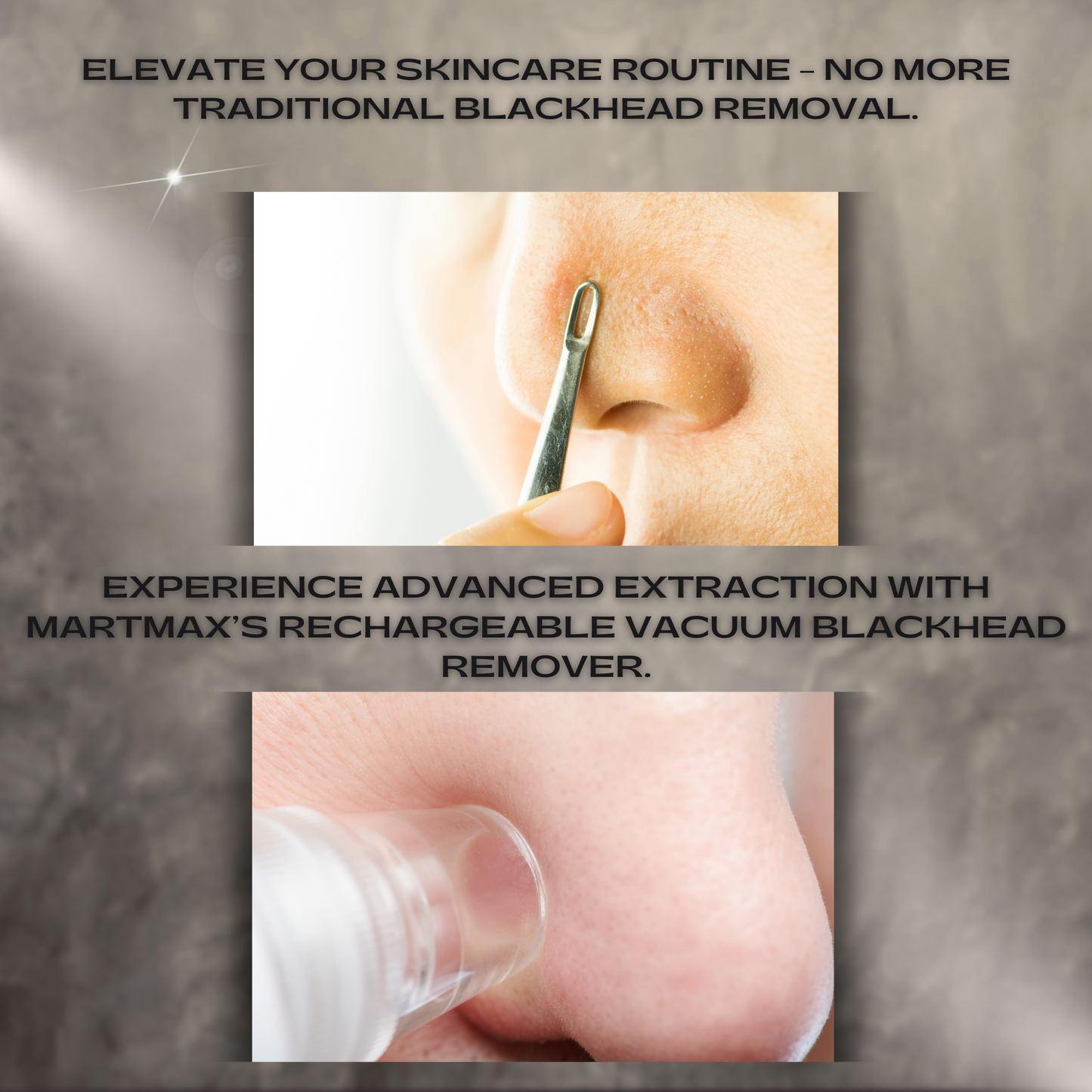 MartMax Electric Vacuum Blackhead Remover.